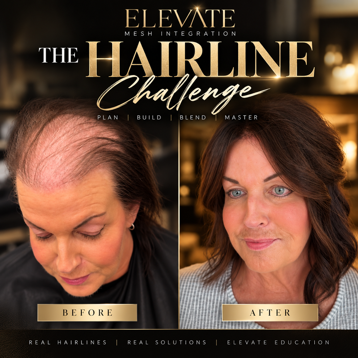 The Hairline Challenge by Elevate Mesh Integration: before and after of a client's hairline, from visible thinning and recession to a full, natural front after a mesh integration install. Plan, Build, Blend, Master.
